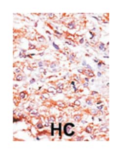 GUCY1A2 Rabbit anti-Human, Mouse, Polyclonal Antibody, Abnova 400 &mu;L | Buy Online | Abnova Corporation | Fisher Scientific