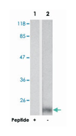 STMN1 Rabbit anti-Human, Mouse, Rat, Polyclonal Antibody, Abnova 100 &mu;g | Buy Online | Abnova Corporation | Fisher Scientific