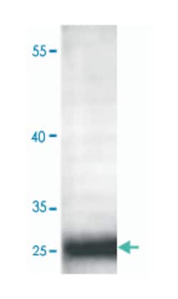 ADIPOQ Rabbit anti-Human, Polyclonal Antibody, Abnova 100 &mu;g | Buy Online | Abnova Corporation | Fisher Scientific