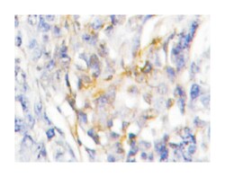 FXR2, Rabbit, Polyclonal Antibody, Abnova 100 &mu;L | Buy Online | Abnova Corporation | Fisher Scientific
