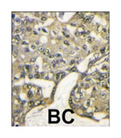 AKT1 Rabbit anti-Human, Polyclonal Antibody, Abnova 400 &mu;L | Buy Online | Abnova Corporation | Fisher Scientific