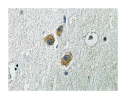 ME3 Rabbit anti-Human, Mouse, Polyclonal Antibody, Abnova 100 &mu;L | Buy Online | Abnova | Fisher Scientific