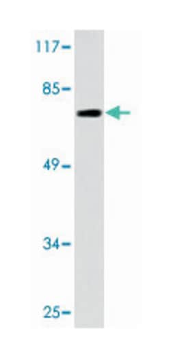 CDC16 Rabbit anti-Human, Mouse, Polyclonal Antibody, Abnova 100 &mu;L | Buy Online | Abnova | Fisher Scientific
