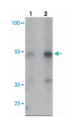 KREMEN2, Rabbit, Polyclonal Antibody, Abnova 100&mu;g; Unlabeled:Antibodies,