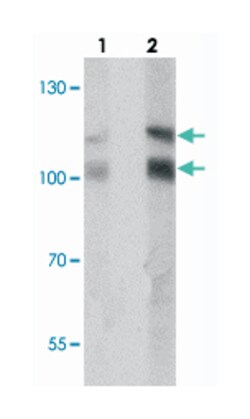 RNF20, Rabbit, Polyclonal Antibody, Abnova 100&mu;g; Unlabeled:Antibodies,