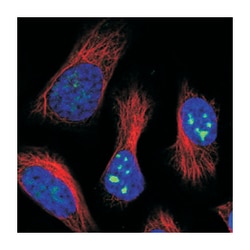 CCDC61, Rabbit, Polyclonal Antibody, Abnova 100 &mu;L | Buy Online | Abnova Corporation | Fisher Scientific