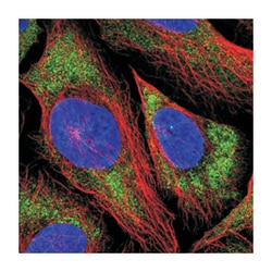 TBC1D30 Rabbit anti-Human, Polyclonal Antibody, Abnova 100 &mu;L | Buy Online | Abnova Corporation | Fisher Scientific