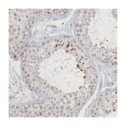 ZNF674, Rabbit, Polyclonal Antibody, Abnova 100 &mu;L | Buy Online | Abnova Corporation | Fisher Scientific