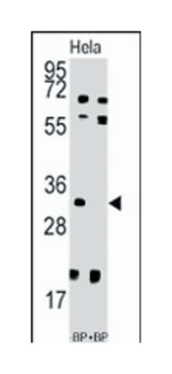 UCK2 Rabbit anti-Human, Polyclonal Antibody, Abnova 400&mu;L; Unlabeled:Antibodies,