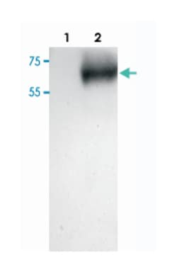 UGT8, Goat, Polyclonal Antibody, Abnova 100 &mu;g | Buy Online | Abnova Corporation | Fisher Scientific