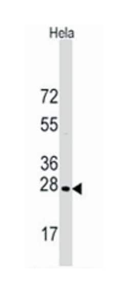 HSPB1 Rabbit anti-Human, Polyclonal Antibody, Abnova 400 &mu;L | Buy Online | Abnova Corporation | Fisher Scientific