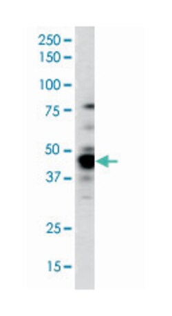 CAMK1D Rabbit anti-Human, Polyclonal Antibody, Abnova 400&mu;L; Unlabeled:Antibodies,