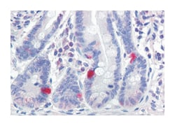 SCN9A, Rabbit, Polyclonal Antibody, Abnova 50 &mu;g | Buy Online | Abnova Corporation | Fisher Scientific