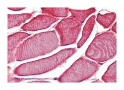 TRPV2 Rabbit anti-Human, Polyclonal Antibody, Abnova 50 &mu;g | Buy Online | Abnova Corporation | Fisher Scientific