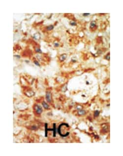 MAPK12 Rabbit anti-Human, Mouse, Polyclonal Antibody, Abnova 400 &mu;L | Buy Online | Abnova Corporation | Fisher Scientific