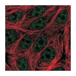 C19orf47 Rabbit anti-Human, Polyclonal Antibody, Abnova 100 &mu;L | Buy Online | Abnova Corporation | Fisher Scientific