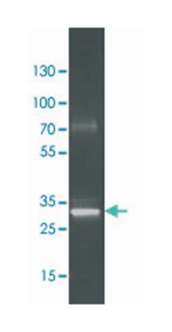 ansB, Rabbit, Polyclonal Antibody, Abnova 100μg; Unlabeled:Antibodies,