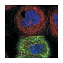 TACSTD2, Rabbit, Polyclonal Antibody, Abnova 100 &mu;L | Buy Online | Abnova Corporation | Fisher Scientific