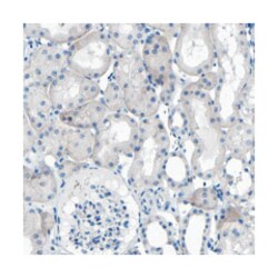 C1orf210, Rabbit, Polyclonal Antibody, Abnova 100&mu;L; Unlabeled:Antibodies,