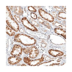 TTLL8, Rabbit, Polyclonal Antibody, Abnova 100 &mu;L | Buy Online | Abnova Corporation | Fisher Scientific