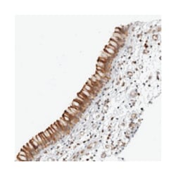 CNBD1 Rabbit anti-Human, Polyclonal Antibody, Abnova 100&mu;L; Unlabeled:Anticuerpos