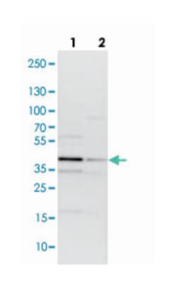 TRIB2, Rabbit, Polyclonal Antibody, Abnova 100 &mu;L | Buy Online | Abnova Corporation | Fisher Scientific