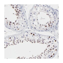 DNMT1 Rabbit anti-Human, Polyclonal Antibody, Abnova 100 &mu;L | Buy Online | Abnova Corporation | Fisher Scientific