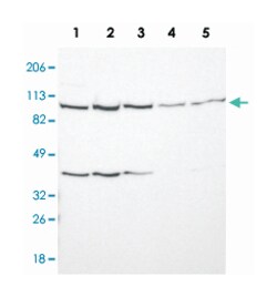 USP51, Rabbit, Polyclonal Antibody, Abnova 100 &mu;L | Buy Online | Abnova Corporation | Fisher Scientific