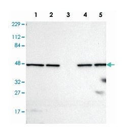 PSMC4, Rabbit, Polyclonal Antibody, Abnova 100&mu;L; Unlabeled:Antibodies,