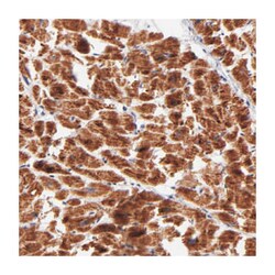 NDUFB7, beta subcomplex 1, Rabbit, Polyclonal Antibody, Abnova 100&mu;L;