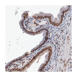 AKT1 Rabbit anti-Human, Polyclonal Antibody, Abnova 100 &mu;L | Buy Online | Abnova | Fisher Scientific