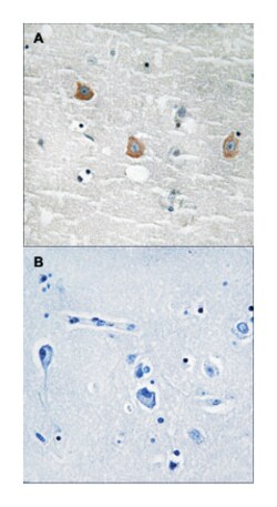 TOB1, Rabbit, Polyclonal Antibody, Abnova 100&mu;L; Unlabeled:Antibodies,
