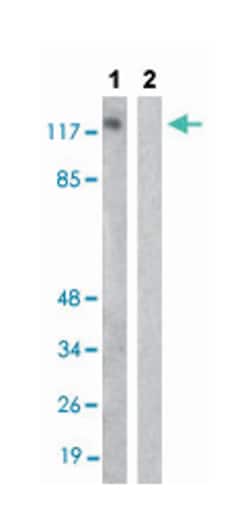 TNK2 (phospho Y284), Rabbit anti-Human, Polyclonal Antibody, Abnova 100&mu;L;