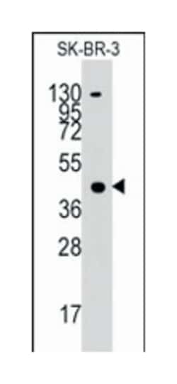 ACAT1 Rabbit anti-Human, Polyclonal Antibody, Abnova 400 &mu;L | Buy Online | Abnova Corporation | Fisher Scientific
