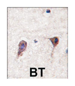 HS2ST1 Rabbit anti-Human, Polyclonal Antibody, Abnova 400 &mu;L | Buy Online | Abnova Corporation | Fisher Scientific