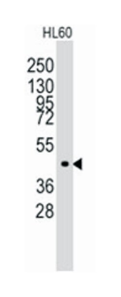 LMX1A Rabbit anti-Human, Mouse, Polyclonal Antibody, Abnova 400 &mu;L | Buy Online | Abnova Corporation | Fisher Scientific