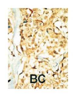 TNIK Rabbit anti-Human, Mouse, Polyclonal Antibody, Abnova 400 &mu;L | Buy Online | Abnova Corporation | Fisher Scientific
