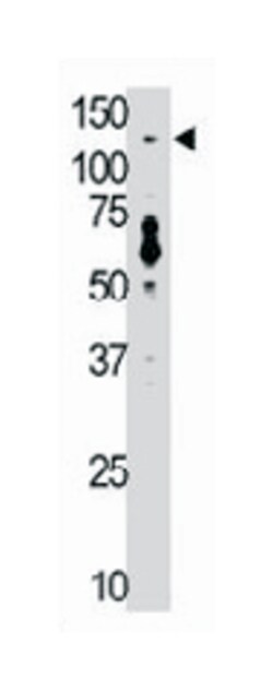 TLR7 Rabbit anti-Human, Mouse, Polyclonal Antibody, Abnova 400 &mu;L | Buy Online | Abnova Corporation | Fisher Scientific