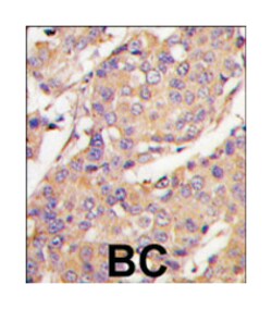 UBE2L6, Rabbit, Polyclonal Antibody, Abnova 400 &mu;L | Buy Online | Abnova Corporation | Fisher Scientific