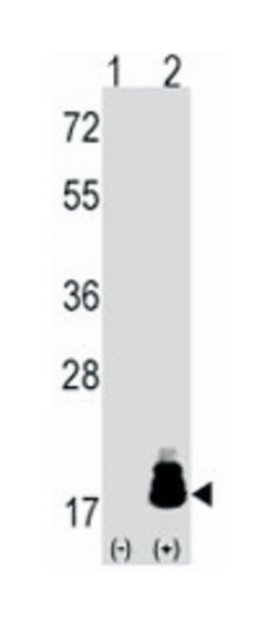 EIF4EBP1 Rabbit anti-Human, Polyclonal Antibody, Abnova 400&mu;L; Unlabeled:Antibodies,