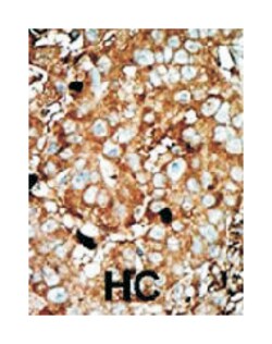 PFKFB3, Rabbit, Polyclonal Antibody, Abnova 400&mu;L; Unlabeled:Antibodies,