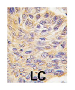 PTPN9, Rabbit, Polyclonal Antibody, Abnova 400&mu;L; Unlabeled:Antibodies,