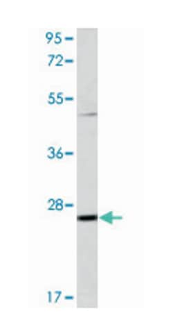 PTP4A3 Rabbit anti-Human, Mouse, Polyclonal Antibody, Abnova 400 &mu;L | Buy Online | Abnova Corporation | Fisher Scientific