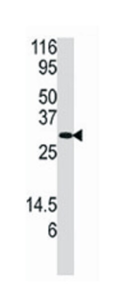 DUSP3 Rabbit anti-Human, Polyclonal Antibody, Abnova 400 &mu;L | Buy Online | Abnova Corporation | Fisher Scientific