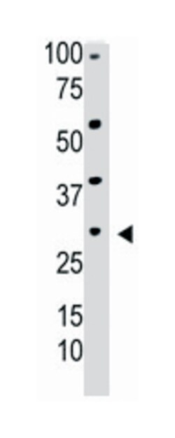 TK2 Rabbit anti-Human, Mouse, Polyclonal Antibody, Abnova 400&mu;L; Unlabeled:Antibodies,
