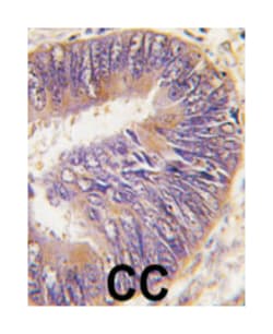 ST13 Rabbit anti-Human, Mouse, Polyclonal Antibody, Abnova 400&mu;L; Unlabeled:Antibodies,