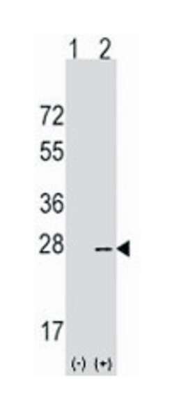 AGR2 Rabbit anti-Human, Polyclonal Antibody, Abnova 400&mu;L; Unlabeled:Antibodies,
