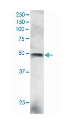 ELF3, Goat, Polyclonal Antibody, Abnova 100 &mu;g | Buy Online | Abnova Corporation | Fisher Scientific