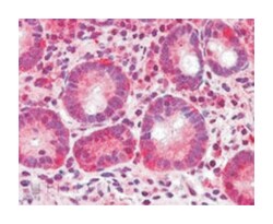 BAZ2B, Goat, Polyclonal Antibody, Abnova 100&mu;g; Unlabeled:Antibodies,