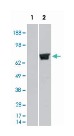 TRIM3, Goat, Polyclonal Antibody, Abnova 100 &mu;g | Buy Online | Abnova Corporation | Fisher Scientific